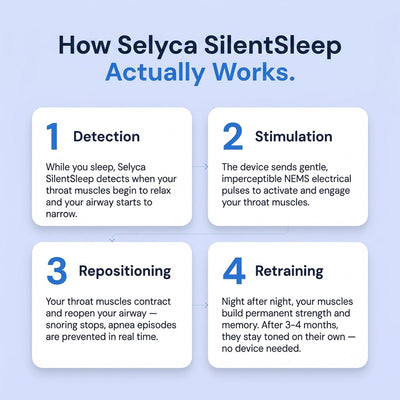 Selyca SilentSleep - Eliminates Snoring & Sleep Apnea